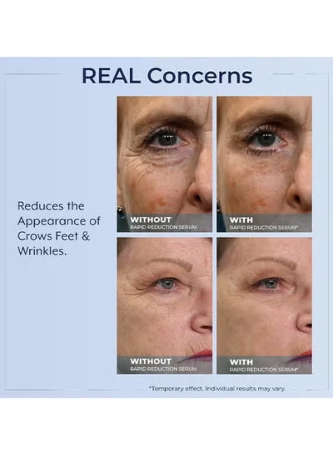 بليكساديرم مصل العين سريع التقليل - يقلل بشكل واضح من الانتفاخات تحت العين والتجاعيد والهالات السوداء والخطوط الدقيقة وأقدام الغراب على الفور ، مزيل التجاعيد المضاد للشيخوخة للوجه ، أنبوب بالحجم الكامل - Image 5